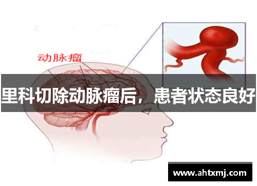 里科切除动脉瘤后，患者状态良好